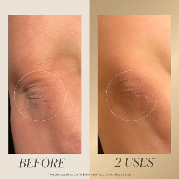 Kate Somerville ExfoliKate Resurfacing Body Scrub - Picture 4 of 8